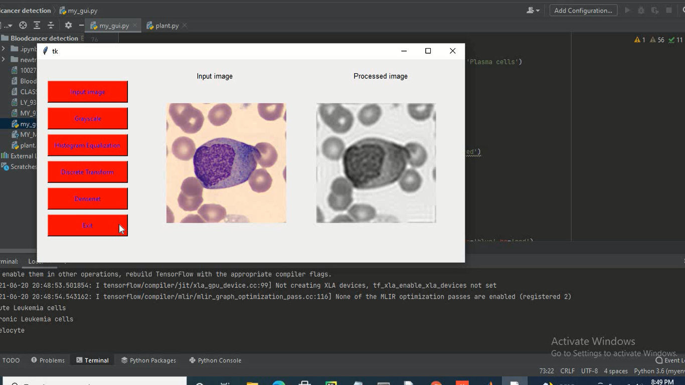 Blood Cancer Cell Classification Using DenseNet Medical Image Classification Using A Light-Weighted Hybrid Neural Network Based On PCANet And DenseNet